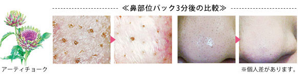 毛穴やたるみを引き締め、キメを整え、ニキビを予防